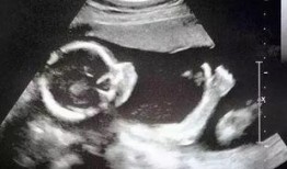 网友爆料b超室的视频,真实影像揭示医疗黑幕